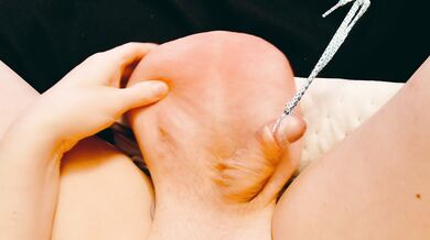 Saline Balls - Stretching Out 4